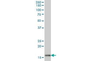 AGR2 monoclonal antibody (M03), clone 1C3 Western Blot analysis of AGR2 expression in MCF-7 . (AGR2 antibody  (AA 1-175))