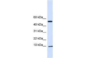 WB Suggested Anti-ATPIF1 Antibody Titration:  0. (ATPase Inhibitory Factor 1 antibody  (N-Term))