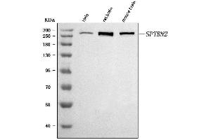 Western blot analysis of SPTBN2 using anti-SPTBN2 antibody (ABIN7602111).