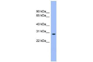 ENOPH1 antibody used at 1 ug/ml to detect target protein. (MASA antibody  (N-Term))