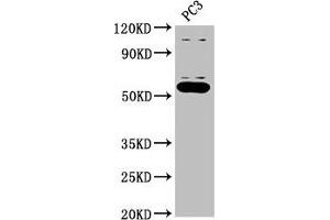 Western Blot Positive WB detected in: PC-3 whole cell lysate All lanes: OMA1 antibody at 2. (OMA1 antibody  (AA 22-194))