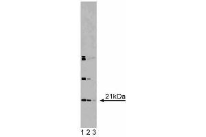 Western blot analysis of DHFR on RSV-3T3 lysate. (Dihydrofolate Reductase antibody  (AA 1-186))