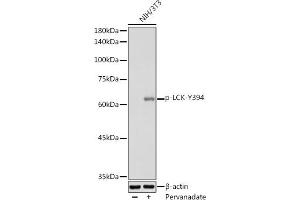 Western blot analysis of extracts of NIH/3T3 cells, using Phospho-LCK-Y394 antibody (ABIN3019739, ABIN3019740, ABIN3019741 and ABIN7101863) at 1:1000 dilution. (LCK antibody  (pTyr394))