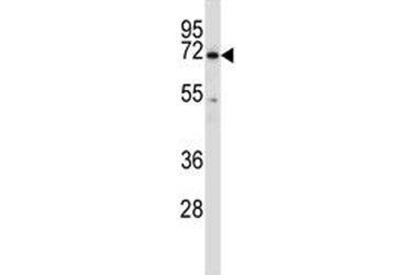 BTK antibody  (AA 27-55)