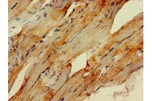 Immunohistochemistry of paraffin-embedded human skeletal muscle tissue using ABIN7151009 at dilution of 1:100