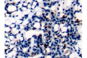 Immunohistochemistry (IHC) image for anti-Protein tyrosine Phosphatase, Receptor Type, C (PTPRC) (AA 371-556) antibody (ABIN7437023)