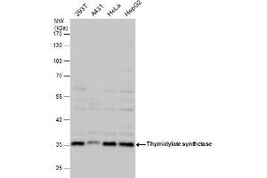 WB Image Thymidylate synthetase antibody detects Thymidylate synthetase protein by western blot analysis.
