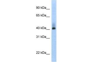 Western Blotting (WB) image for anti-Ankyrin Repeat Domain 42 (ANKRD42) antibody (ABIN2462361) (ANKRD42 antibody)