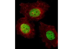 Fluorescent image of MCF-7 cell stained with TREF1 Antibody (C-term) (ABIN653305 and ABIN2842805). (TRERF1 antibody  (C-Term))