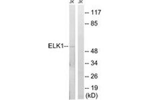 Western blot analysis of extracts from JurKat cells, using Elk1 (Ab-383) Antibody.