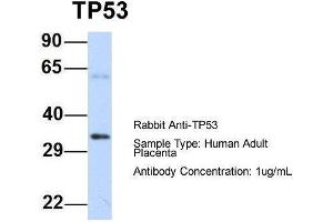 Host: Rabbit  Target Name: TP53  Sample Tissue: Human Adult Placenta  Antibody Dilution: 1. (p53 antibody  (N-Term))