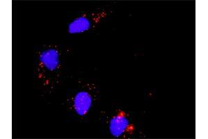 Proximity Ligation Analysis of protein-protein interactions between MAPK3 and ATF2. (ATF2 antibody  (AA 91-190))