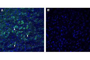 Expression of CADM1 in mouse basal forebrain.