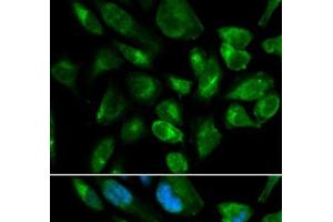 Immunofluorescence analysis of HepG2 cells using KIR2DL3 Polyclonal Antibody (KIR2DL3 antibody)