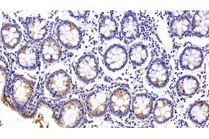 Detection of PALLD in Human Colon Tissue using Polyclonal Antibody to Palladin (PALLD) (PALLD antibody  (AA 1137-1383))