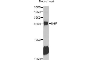 Western blot analysis of extracts of mouse heart, using NGF antibody (ABIN6293296) at 1:1000 dilution. (Nerve Growth Factor antibody)