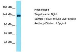 Image no. 1 for anti-Diacylglycerol Kinase, delta 130kDa (DGKD) (AA 449-498) antibody (ABIN6750521) (DGKD antibody  (AA 449-498))