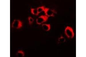 Immunofluorescent analysis of RNF81 staining in SW620 cells. (TRIM21 antibody)