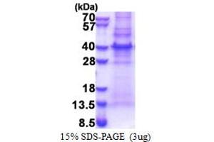 SDS-PAGE (SDS) image for MLF1 Interacting Protein (MLF1IP) (AA 147-418) protein (His tag) (ABIN5853460)