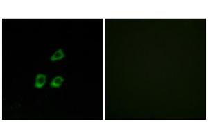 Immunofluorescence analysis of HUVEC cells, using CLCN4 antibody. (CLCN4 antibody  (Internal Region))