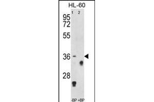 Western blot analysis of anti-TNFRSF14 Antibody (Center) Pab (ABIN653038 and ABIN2842652) pre-incubated without(lane 1) and with(lane 2) blocking peptide in HL-60 cell line lysate.