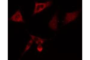 ABIN6275071 staining  A549 cells by IF/ICC. (CD3EAP antibody  (C-Term))