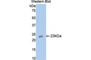Western blot analysis of the recombinant protein. (COMP antibody  (AA 235-423))