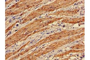 Immunohistochemistry of paraffin-embedded human smooth muscle tissue using ABIN7172847 at dilution of 1:100 (Transgelin antibody  (AA 2-201))