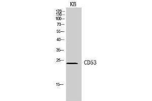 Western Blotting (WB) image for anti-CD53 (CD53) (Internal Region) antibody (ABIN3178937) (CD53 antibody  (Internal Region))