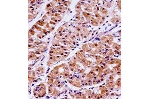Immunohistochemistry analysis in formalin fixed and paraffin embedded human stomach tissue reacted with KLK15 / Kallikrein-15 Antibody (Center) followed by peroxidase conjugation of the secondary antibody and DAB staining.
