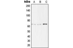 Western blot analysis of TBX15/18 expression in Jurkat (A), HepG2 (B), LOVO (C) whole cell lysates. (T-Box 15/18 antibody  (Center))