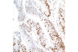 Immunohistochemistry (IHC) image for anti-Proliferating Cell Nuclear Antigen (PCNA) antibody (ABIN7453982) (PCNA antibody)
