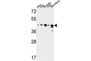 ADH7 Antibody (C-Term) western blot analysis in Jurkat,CEM,NCI-H460,K562,MDA-MB435 cell line lysates (35µg/lane). (ADH7 antibody  (C-Term))