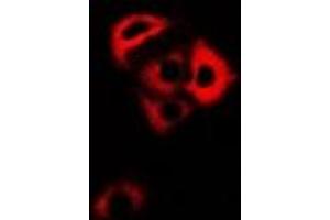 Immunofluorescent analysis of ARFGAP1 staining in HepG2 cells. (ARFGAP1 antibody)