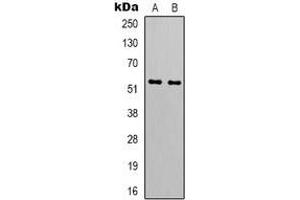 Western blot analysis of GIP Receptor expression in HT1080 (A), A549 (B) whole cell lysates. (GIPR antibody)