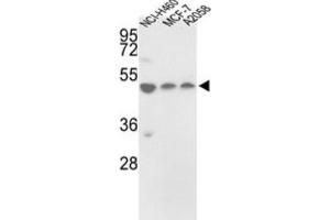 Western Blotting (WB) image for anti-Protein Disulfide Isomerase Family A, Member 6 (PDIA6) antibody (ABIN3002738) (PDIA6 antibody)