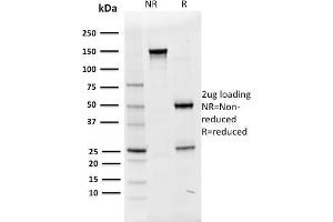 SDS-PAGE Analysis Purified Oct-2 Mouse Monoclonal Antibody (OCT2/2136). (Oct-2 antibody  (AA 112-297))