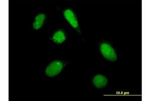 Immunofluorescence of purified MaxPab antibody to PHF20L1 on HeLa cell. (PHF20L1 antibody  (AA 1-285))