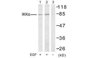 Western blot analysis of extracts from 293 cells (Lane 1) and MDA-MB-435 cells (Lane 2 and 3), untreated or treated with EGF, using IKKα (Ab-23) antibody (E021123). (IKK alpha antibody)
