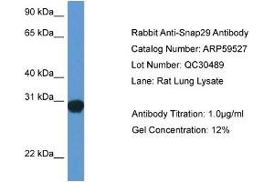 Western Blotting (WB) image for anti-Synaptosomal-Associated Protein, 29kDa (SNAP29) (Middle Region) antibody (ABIN2788104) (SNAP29 antibody  (Middle Region))