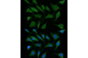 Immunofluorescence analysis of L929 using TRIM45 antibody (ABIN6132737, ABIN6149529, ABIN6149530 and ABIN6216483) at dilution of 1:100 (40x lens). (TRIM45 antibody  (AA 100-400))