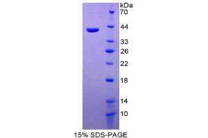 SDS-PAGE (SDS) image for Chemokine (C-C Motif) Ligand 26 (CCL26) (AA 24-94) protein (His tag,GST tag) (ABIN2123235)