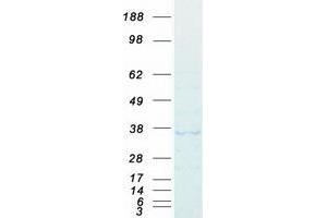 Western Blotting (WB) image for Deleted in Azoospermia-Like (DAZL) protein (Myc-DYKDDDDK Tag) (ABIN2719233)