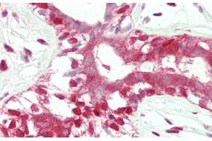 Immunohistochemistry (Paraffin-embedded Sections) (IHC (p)) image for anti-Alcohol Dehydrogenase 5 (Class III), chi Polypeptide (ADH5) (AA 212-239) antibody (ABIN652502)