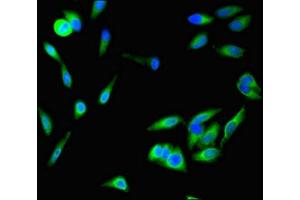 Immunofluorescent analysis of Hela cells using ABIN7168677 at dilution of 1:100 and Alexa Fluor 488-congugated AffiniPure Goat Anti-Rabbit IgG(H+L) (SFRP1 antibody  (AA 170-240))