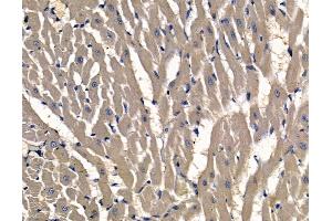 anti-Phosphatase and Actin Regulator 2 (PHACTR2) antibody