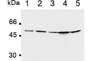Western Blotting (WB) image for anti-Polymerase (DNA Directed), delta 2, Accessory Subunit (POLD2) antibody (ABIN567777)