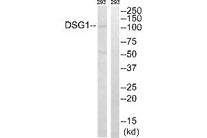 Western blot analysis of extracts from 293 cells, using DSG1 antibody. (Desmoglein 1 antibody  (Internal Region))