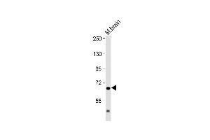 Anti-IL1R Antibody (C-Term) at 1:2000 dilution + Mouse brain lysate Lysates/proteins at 20 μg per lane. (IL1RAP antibody  (AA 484-518))