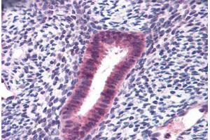 Human Uterus: Formalin-Fixed, Paraffin-Embedded (FFPE) (FOXN1 antibody  (AA 585-648))